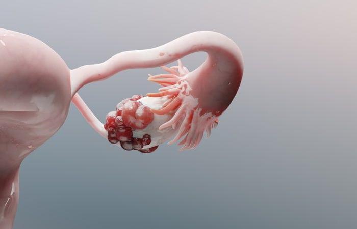Le traitement équin aux œstrogènes uniquement augmente le risque de cancer de l’ovaire
