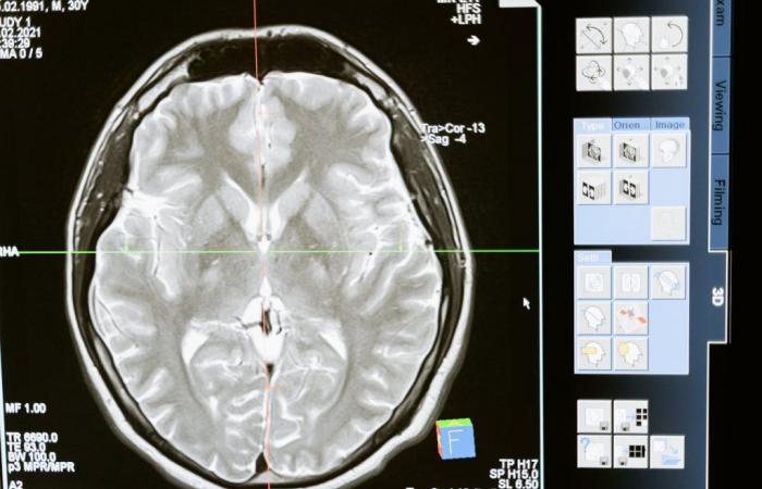Voici 3 choses à faire pour votre cerveau, selon un neurochirurgien – .