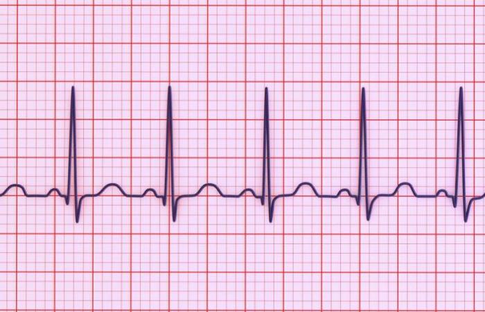 Les
      maladies
      cardiaques
      sont
      trois
      fois
      plus
      fréquentes
      qu’on
      ne
      le
      pensait,
      selon
      une
      étude
      –
      Mon
      blog