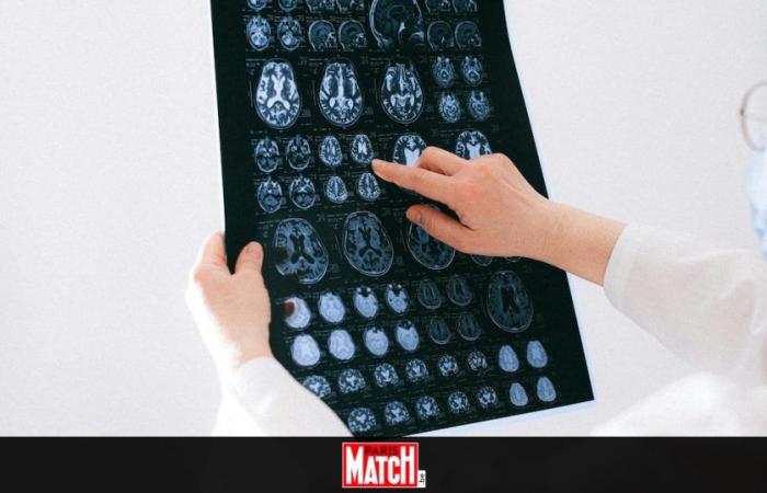 Des superaliments pour un cerveau sain