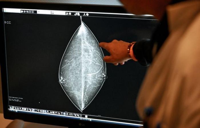 Aucun symptôme, peur du diagnostic… quand les freins au dépistage du cancer du sein ralentissent aussi la guérison dans le Cantal