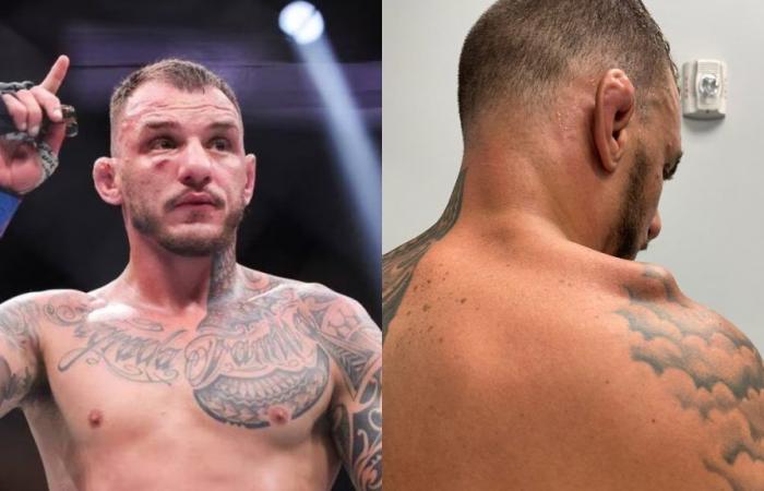 UFC Paris – Renato Moicano, grièvement blessé avant d’affronter BSD