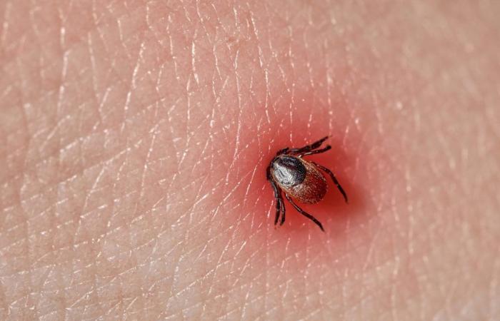 une marche pour sensibiliser à la maladie de Lyme