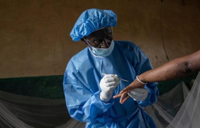 La vaccination Mpox débute samedi à Goma