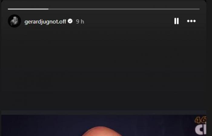 Gérard Jugnot révèle les causes de sa mort