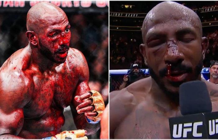 Le nez de Khalil Rountree n’arrêtait pas de jaillir de sang lors de l’interview de Savage post-UFC 307