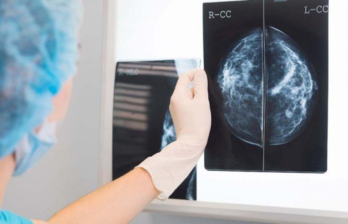 c’est ainsi que l’intelligence artificielle peut détecter rapidement ce cancer