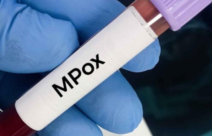 Un nouveau kit de diagnostic Mpox prêt à être commercialisé au Maroc