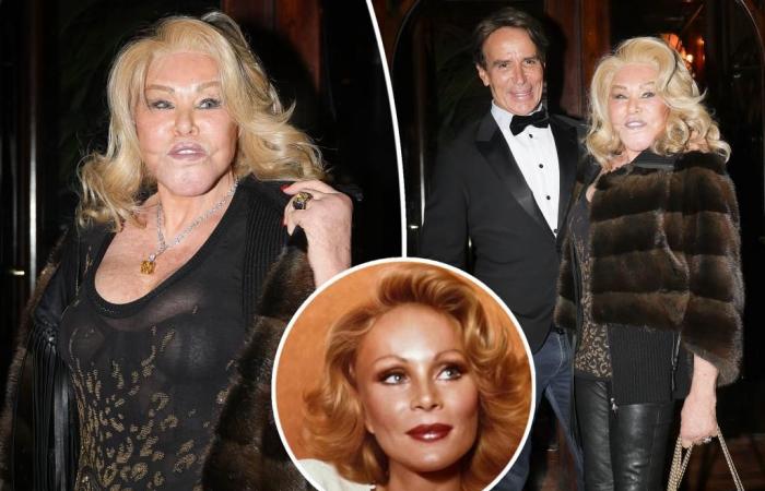 “Catwoman” Jocelyn Wildenstein sort après une photo pré-opératoire