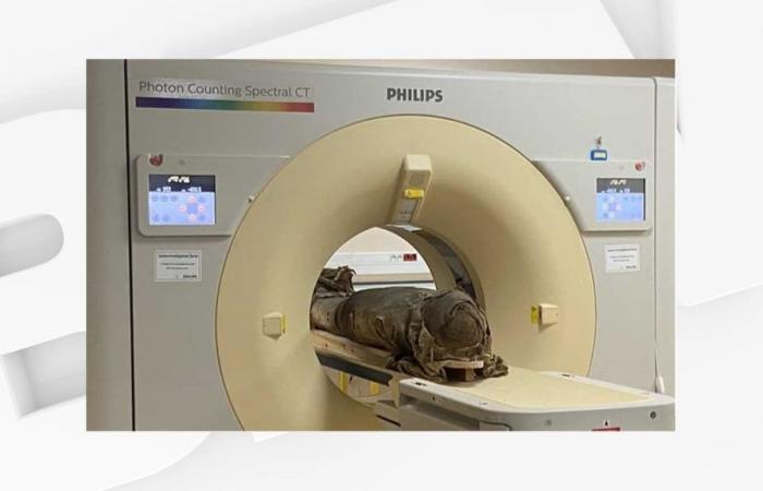 Une momie de 3 000 ans a subi un scanner dans un hôpital de Lyon