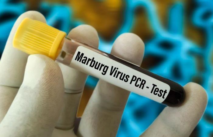 qu’est-ce que le virus Marburg, cette fièvre hémorragique très dangereuse qui sévit actuellement au Rwanda ?