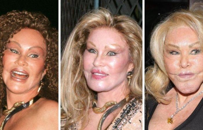 Galerie de transformation de Jocelyn Wildenstein : photos avant et après