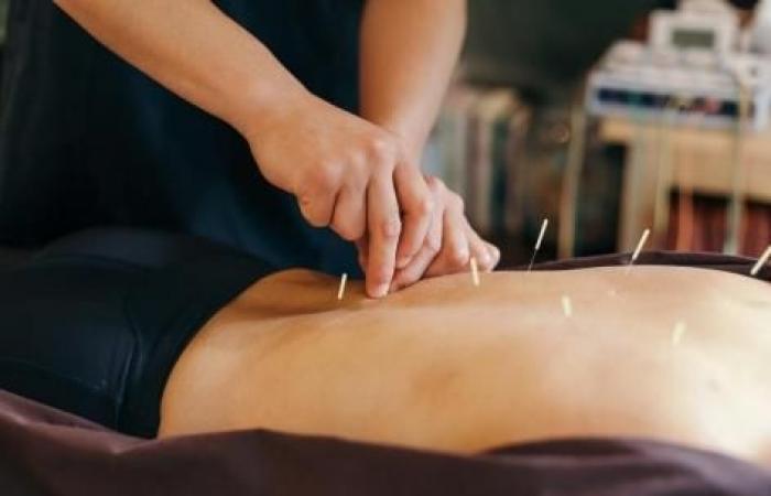 Syndrome du côlon irritable : l’acupuncture soulage les symptômes