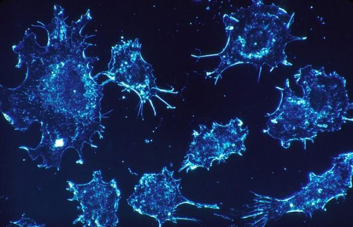 Percée dans la recherche sur le cancer à l’Université de Tel Aviv