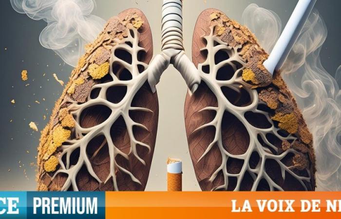 se mobiliser pour la détection précoce du cancer du poumon