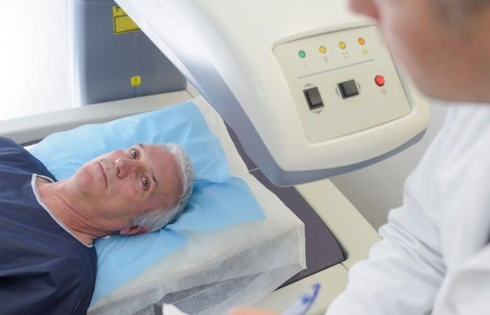 Quels sont les avantages de la radiothérapie stéréotaxique par rapport à la prostatectomie ?