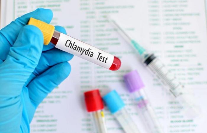 Bientôt un vaccin contre la chlamydia ? Les résultats d’un nouveau test