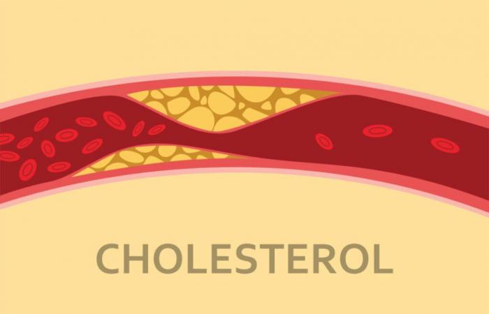 Ce fruit aide à réduire le cholestérol, révèle une étude