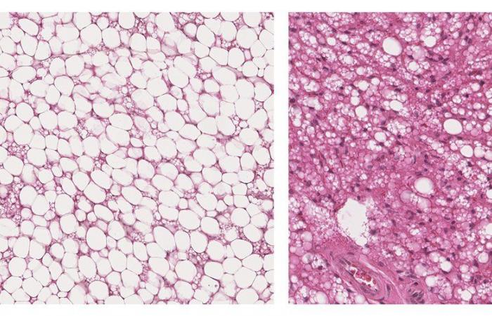 pourquoi ce tissu adipeux méconnu est-il si utile à votre santé ? Une étude toulousaine ouvre de nouvelles perspectives