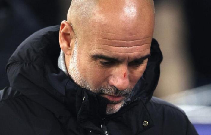 Pep Guardiola explique ses blessures au visage