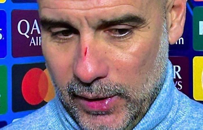 quand Pep Guardiola avoue s’être gratté le visage après l’incroyable nul à Manchester City