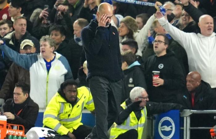 Guardiola explique sa cicatrice au visage