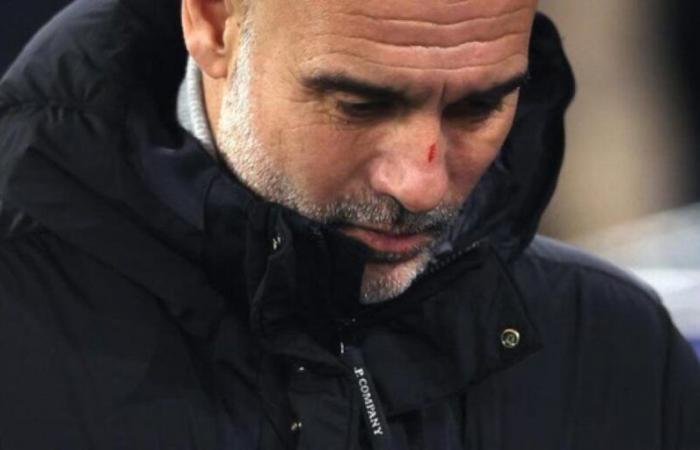 Guardiola nuance ses propos en raison des égratignures sur son visage