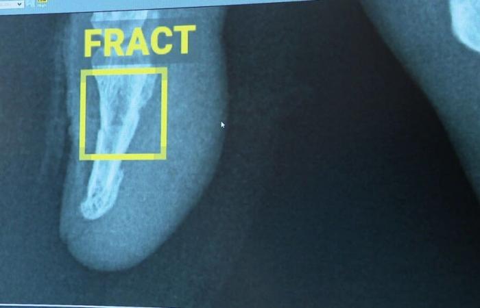 l’intelligence artificielle révolutionne la radiologie