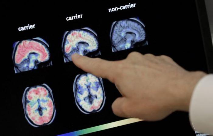 Des chercheurs belges révèlent le rôle des cellules immunitaires du cerveau dans la maladie d’Alzheimer