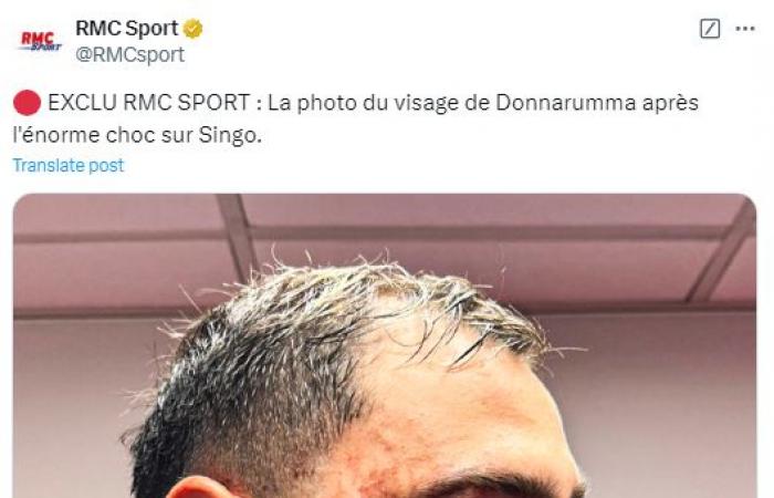 Le visage de Gigi Donnarumma saigne avec une vilaine entaille avant d’être agrafé lors d’un défi d’horreur