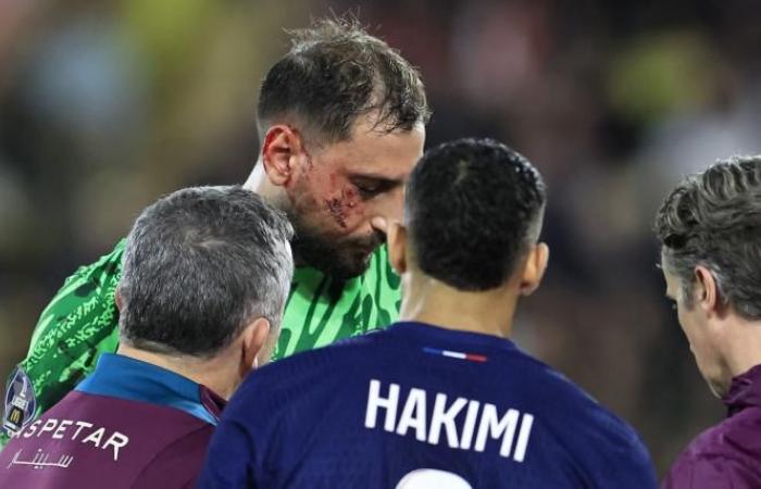 Gianluigi Donnarumma souffre d’une blessure faciale d’horreur qui ne donne même pas lieu à un carton jaune