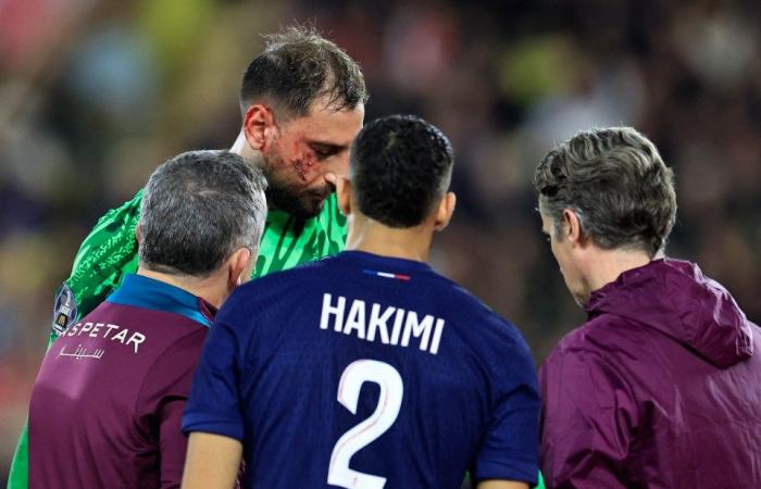 Le visage de Gigi Donnarumma saigne avec une vilaine entaille avant d’être agrafé lors d’un défi d’horreur