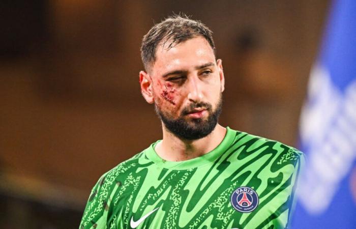 Chevalier monte au créneau après l’énorme semelle sur le visage de Donnarumma