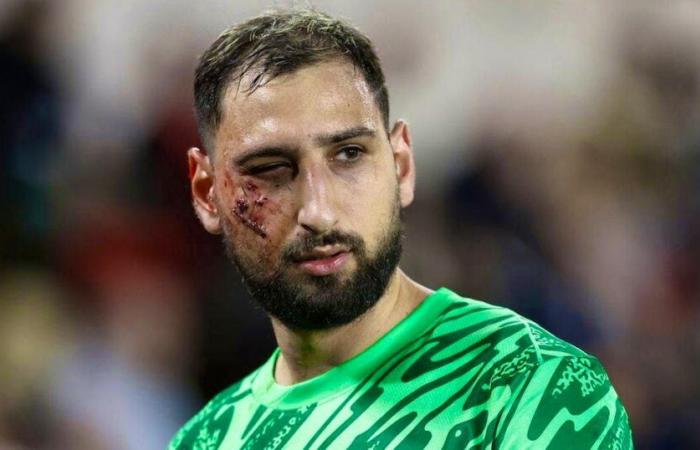 Horrible blessure pour Donnarumma, qui reçoit des crampons au visage