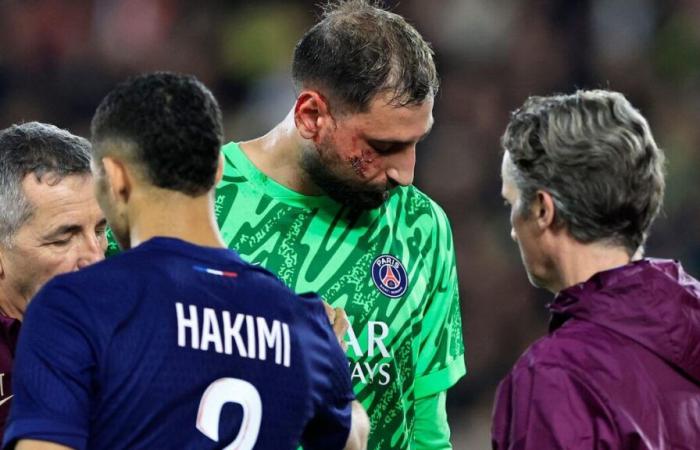 Donnarumma fustigé par ses amis du PSG après sa blessure au visage