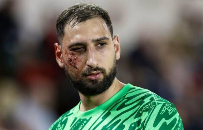 Gigi Donnarumma se prend des crampons au visage