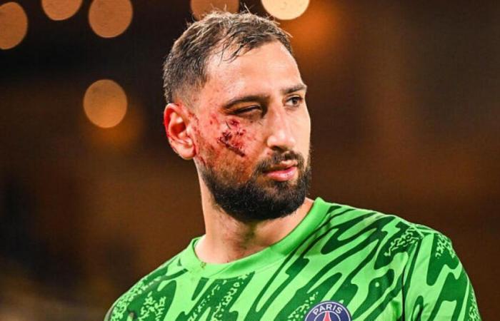 après son choc à la tête, Gianluigi Donnarumma donne des nouvelles rassurantes !