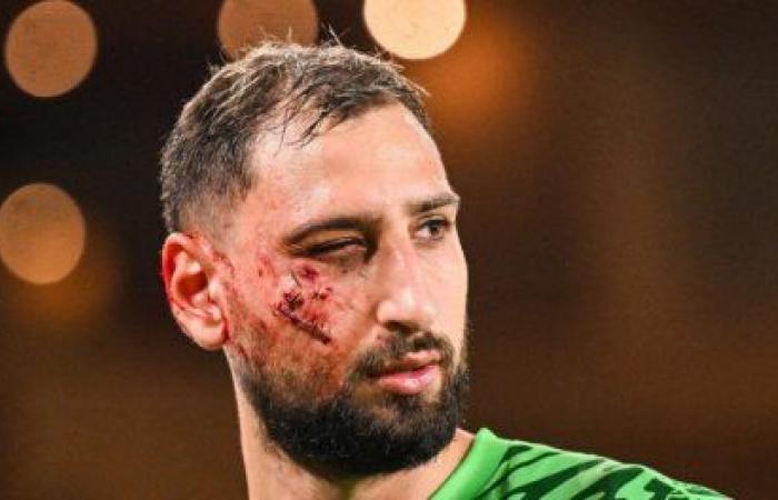 Traumatisme facial avec plaies multiples pour Donnarumma, forfait à Lens