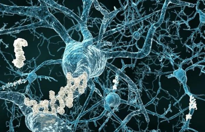 Des chercheurs identifient un mécanisme clé liant le stress cérébral à la maladie d’Alzheimer