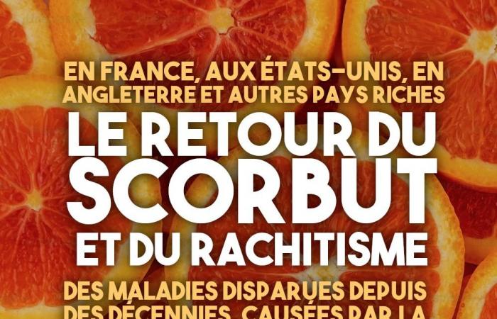 Le retour du scorbut dans les pays riches – Counter Attack