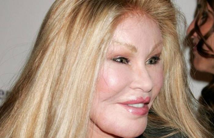 Mort à Paris de la « femme chat » Jocelyn Wildenstein, figure de la jet-set connue pour ses nombreuses opérations de chirurgie esthétique