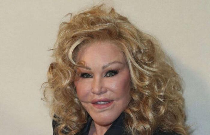 Mort de Jocelyn Wildenstein, la « femme chat » de la jet-set