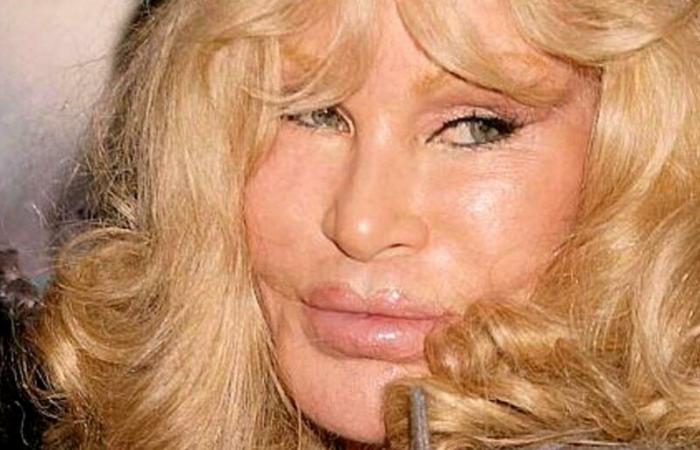 Jocelyne Wildenstein, la « femme chat », est morte