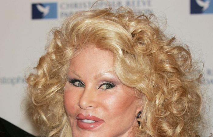 Jocelyne Wildenstein, surnommée la « femme chat » et figure de la jet-set, est morte