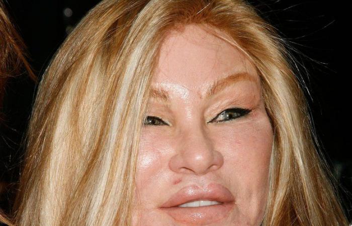 Quelles opérations Jocelyne Wildenstein, surnommée la « femme chat » a-t-elle subie ?