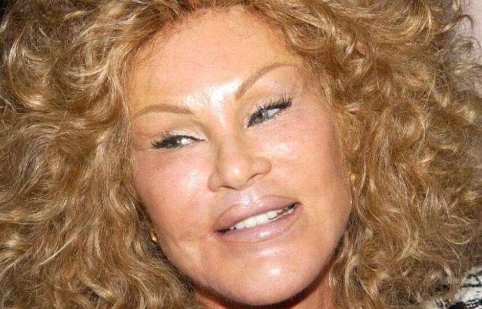 Jocelyne Wildenstein, « Catwoman » mondaine et tabloïd, décède à 79 ans