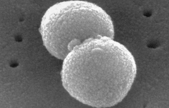 Qu’est-ce que la pneumonie, quels sont les symptômes les plus courants et comment la traiter ?