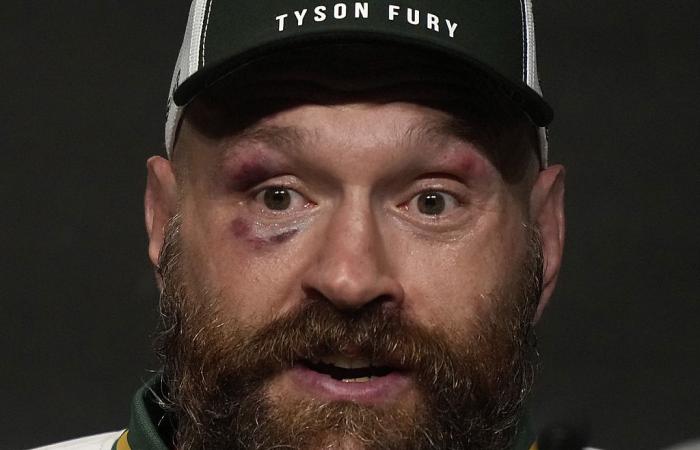 Tyson Fury annonce sa retraite