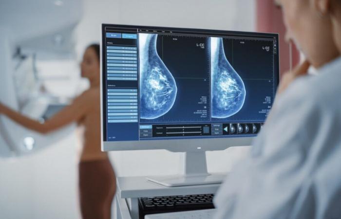 L’intelligence artificielle pourrait révolutionner le dépistage du cancer du sein