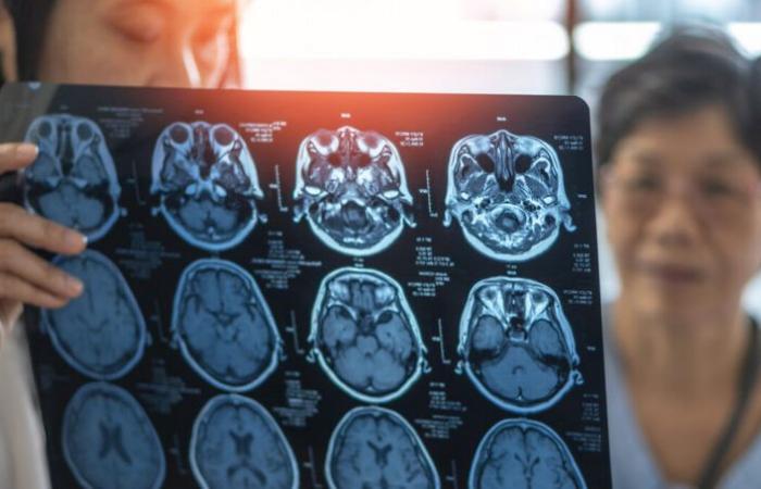 Ces médicaments pour le cœur ralentissent le déclin cognitif